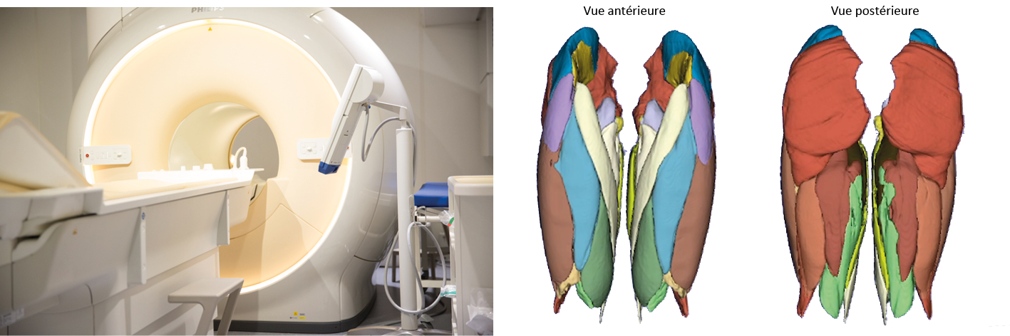 Figure&nbsp;2 – a. IRM pôle imagerie INSEP&nbsp;; b. Reconstitution des volumes musculaires par IA.